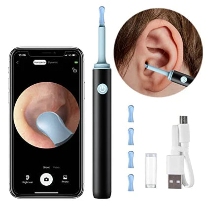 RADIANZ™   - PROFESSIONAL EAR WAX REMOVAL TOOL